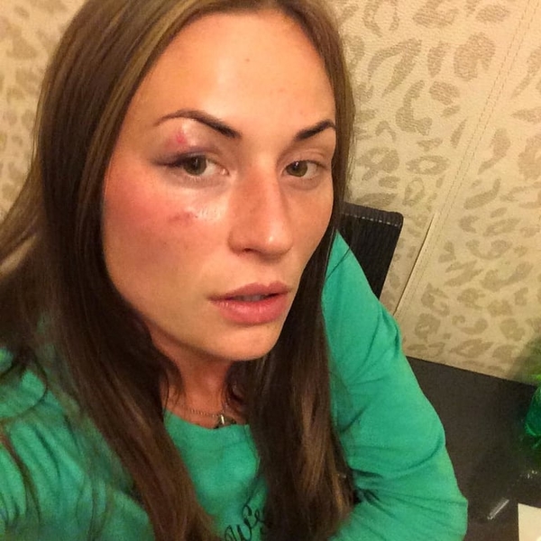 В Киеве избили телеведущую, пытавшуюся защитить девушку