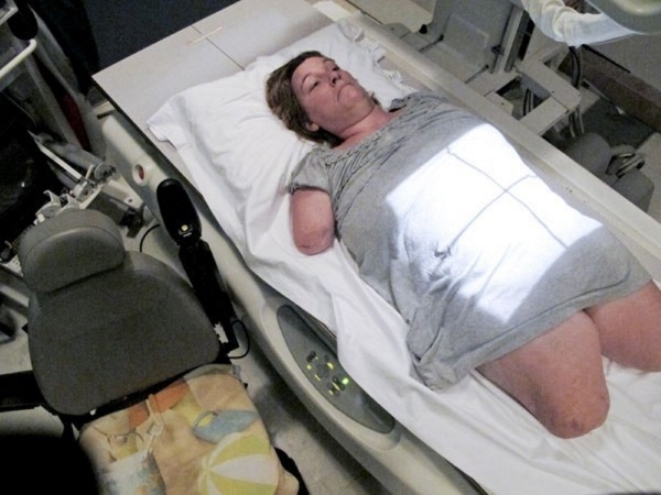 Американка лишилась рук и ног, чтобы спасти своего ребенка