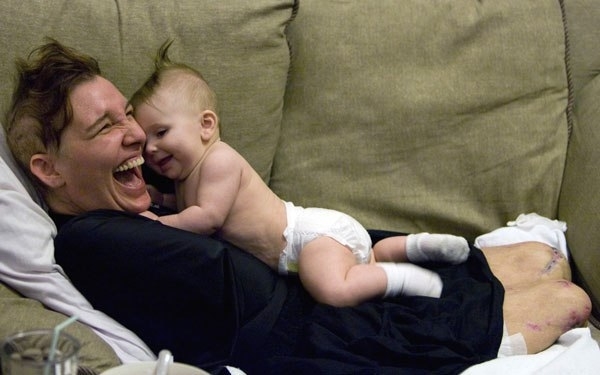 Американка лишилась рук и ног, чтобы спасти своего ребенка