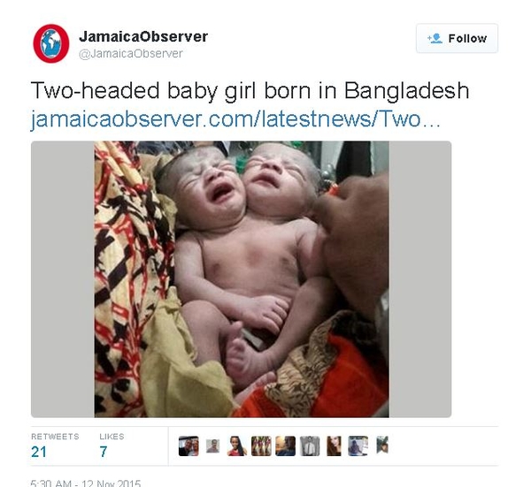 В Бангладеше родилась малышка с двумя головами