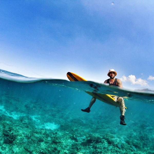Тимати оказался на операционном столе после занятий серфингом