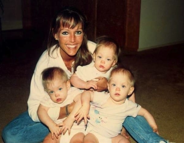 После пожара сестры потеряли маму и свои милые лица, но не веру