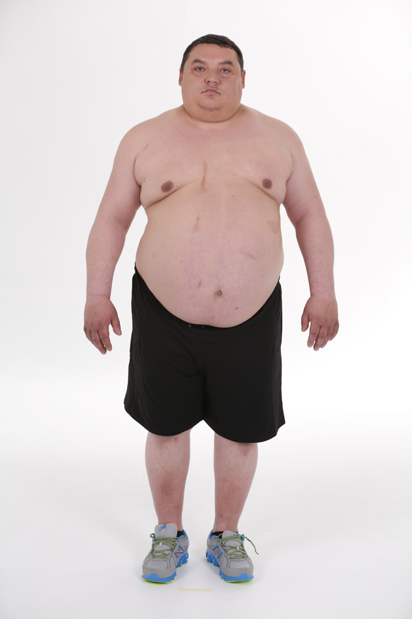 Победитель Зважені та щасливі 5 Саша Репьянчук: Хочу на выигранные деньги открыть зал