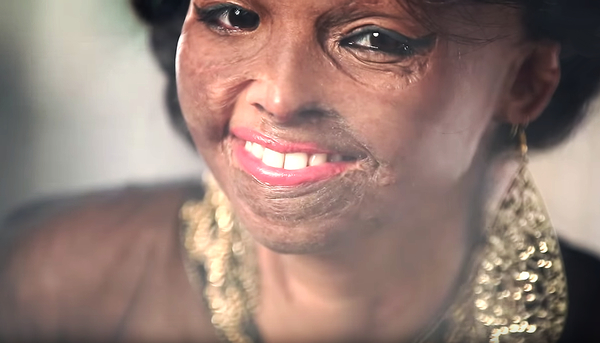 Жертва кислотного нападения снялась в новом кампейне модного бренда