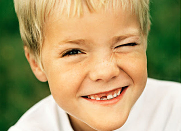 Косоглазие: лечить или не лечить?