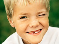 Косоглазие: лечить или не лечить?