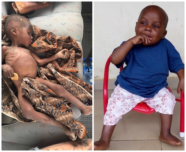 Шанс на нормальную жизнь: история спасения африканского малыша