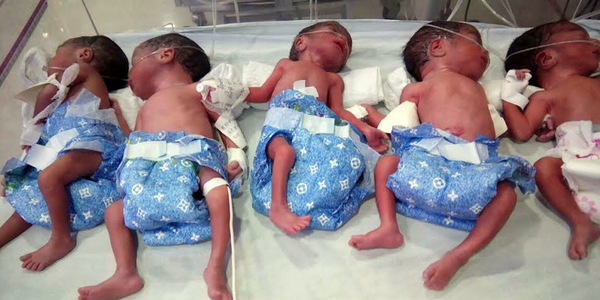 Индианка родила пятерню, думая, что беременна одним ребенком