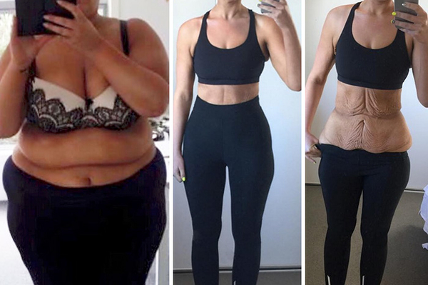 Simone's Journey to Health