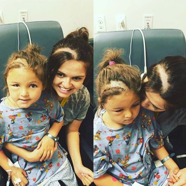 Мать выбрила "шрам" на голове, чтобы поддержать дочку