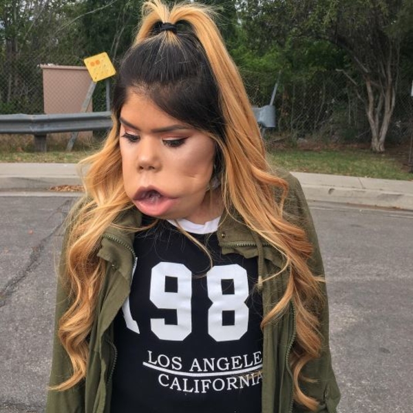 Beauty-блогер с деформацией лица покорила пользователей Сети