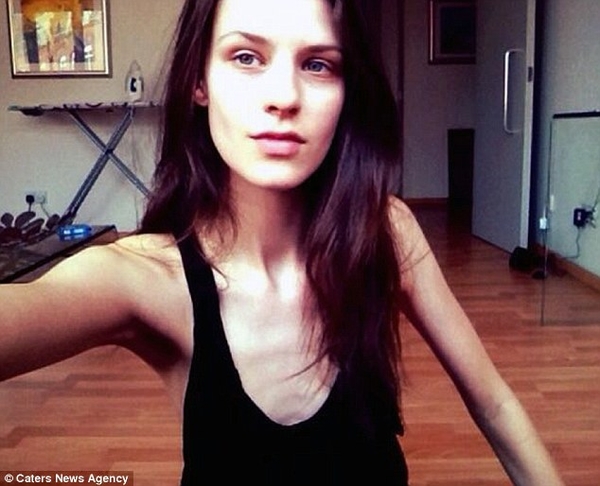 Модель с обложки Vogue обвинила индустрию моды в своей анорексии