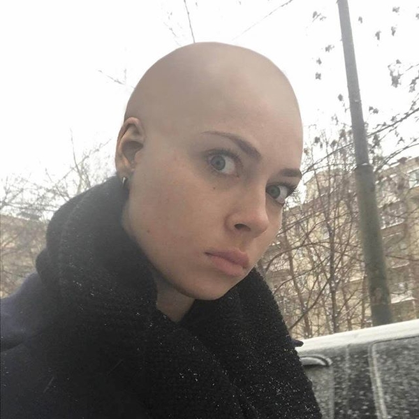 Звезда сериала Универ. Новая общага постриглась налысо