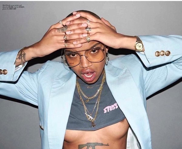 Как модели с нестандартной внешностью меняют мир моды