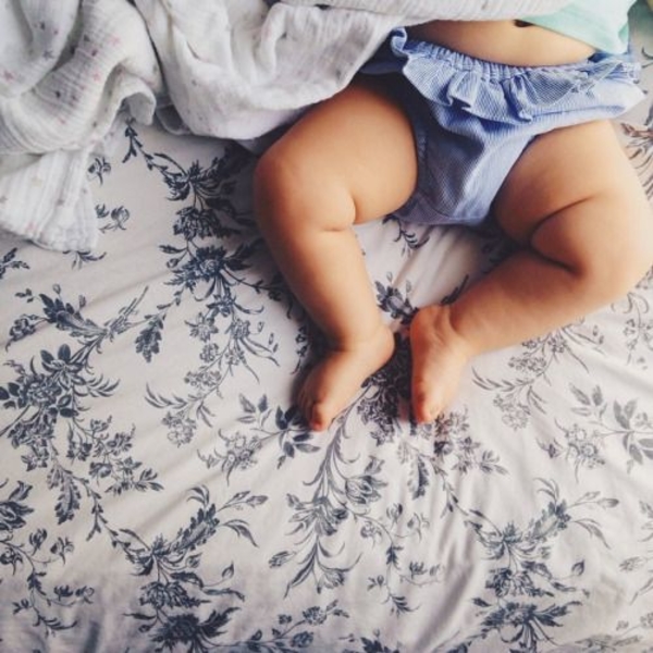 Почему возникают опрелости и как с ними бороться