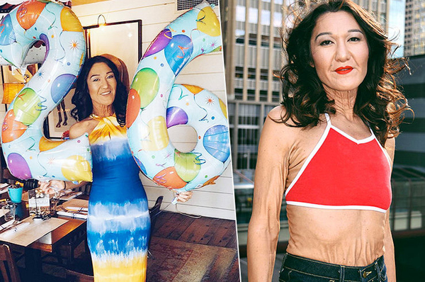 26-летняя модель выглядит на 50 из-за редкой болезни