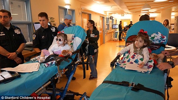 Врачи успешно разделили уникальных сиамских близнецов