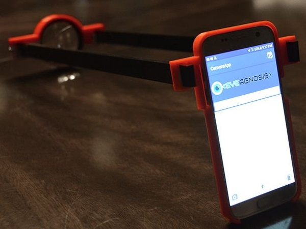 Школьница из США создала приложение для диагностики слепоты