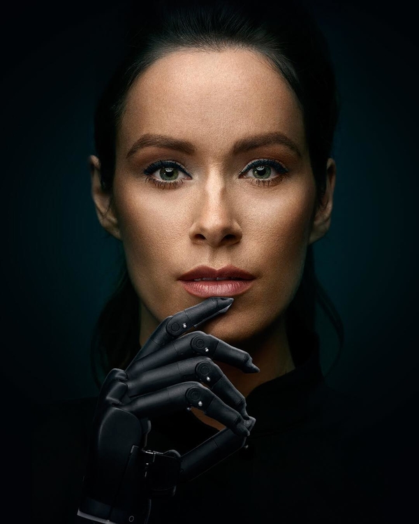 Модель с бионическим протезом руки возвращается на подиум