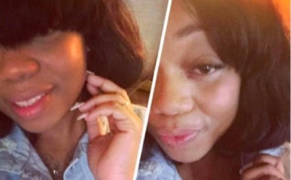 Молодая американка умерла из-за желания стать второй Ким Кардашян