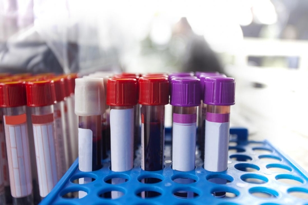 Реальная угроза: британцы сообщают о венерическом заболевании, которое «не берут» антибиотики