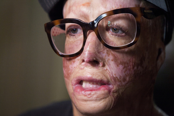 Умер "сын" Майкла Джексона