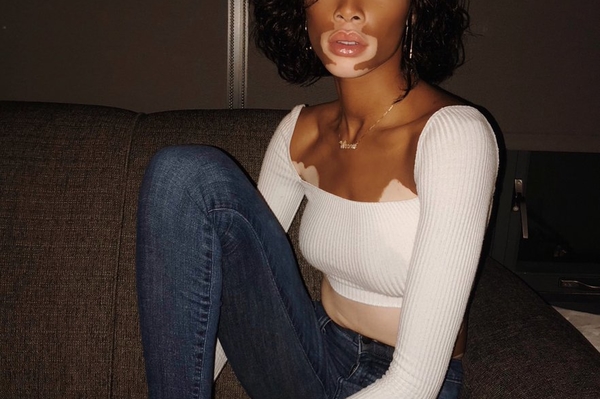 twitter.com/winnieharlow