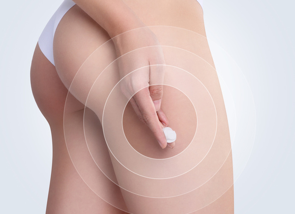 5 распространенных мифов о целлюлите, которые нужно забыть