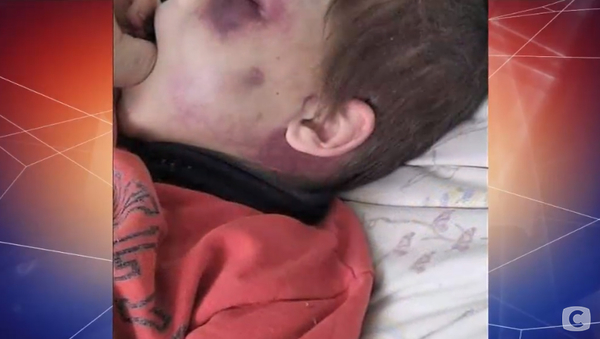 На "Один за всех" выяснят, кто из родителей избил 6-летнего сына