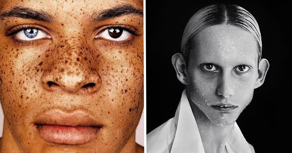 Против правил: ТОП-5 мужчин с необычной внешностью, которые стали звездами