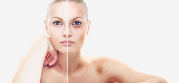 Синяки под глазами: Основные причины появление у детей, женщин и мужчин