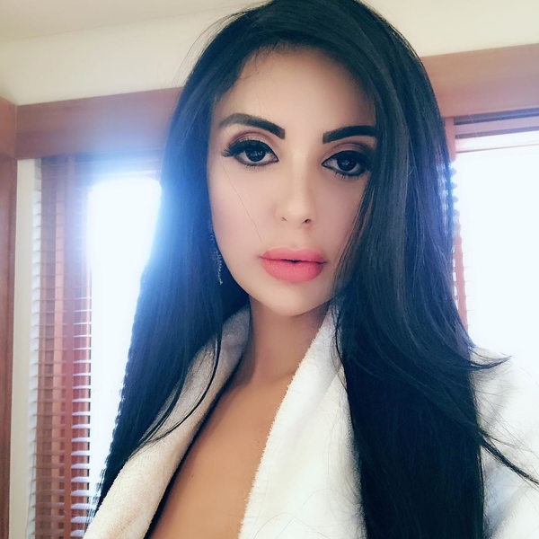 "Последняя - неудачная": Актриса сделала 20 операций, чтобы стать похожей на Кардашьян