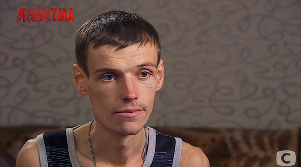 “Я соромлюсь свого тіла”: впервые пациентом станет мужчина с анорексией