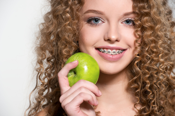 Как питаться после установки брекетов