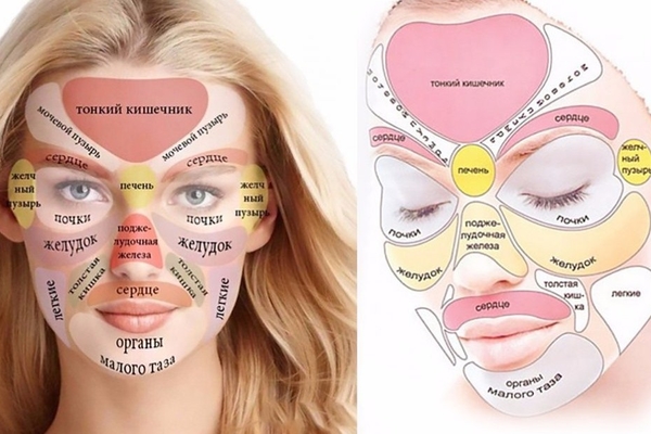 Симптом “Прыщи на лице” может проявляться в следующих заболеваниях: