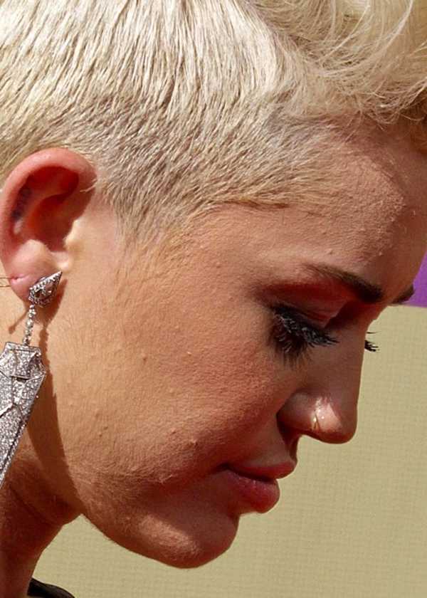 Проблемный вопрос: ТОП-7 звезд с плохой кожей