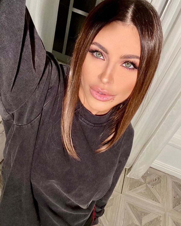 Не умеете фотошопить: Лорак выставила новое фото и нарвалась на критику