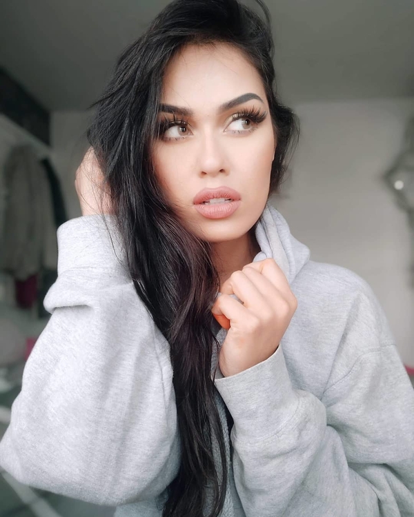 Последствия борьбы с COVID-19: Мисс Англия шокировала обезображенным лицом