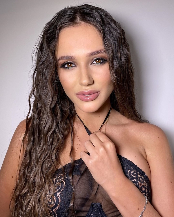 Победительницу "Холостяка"-10 заподозрили в новых "переделках" внешности