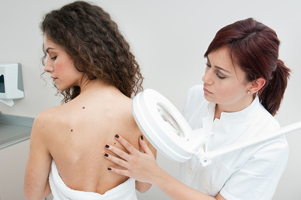 Опасные и безопасные  родинки: как определить