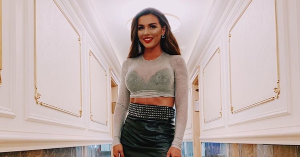 "Мне говорили, что я жирная": Седокова призналась, что сделала липосакцию в 21 год