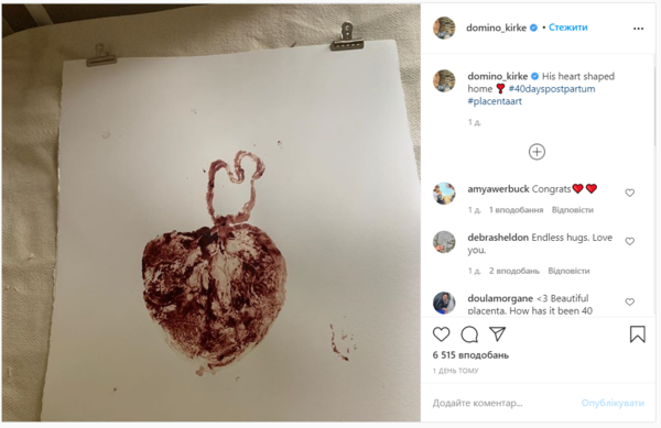 Звезда сериала "Сплетница" Пенн Бэджли впервые стал отцом