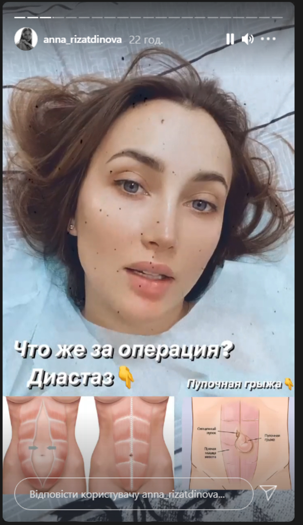 Анна Ризатдинова перенесла две операции: Что случилось