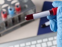 Как сдавать кровь, чтобы анализы были правдивыми – советы медика