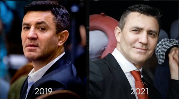 Эксперт рассекретил, делал ли пластику Николай Тищенко