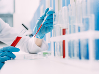 Индекс НОМА: что это такое и как сдавать анализ